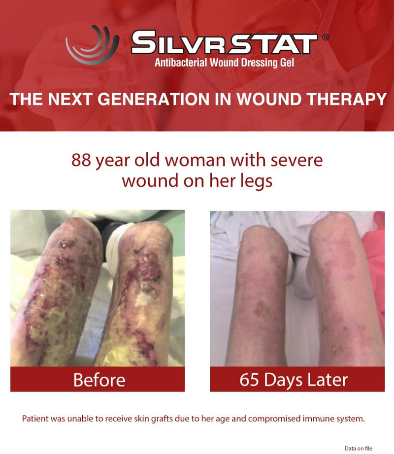 [Australia - AusPower] - First Aid Kit Gel | 32 PPM Silver Healing Wound Dressing Solution | SilverSol Ag₄O₄ Particles | 3 oz 3 Ounce 