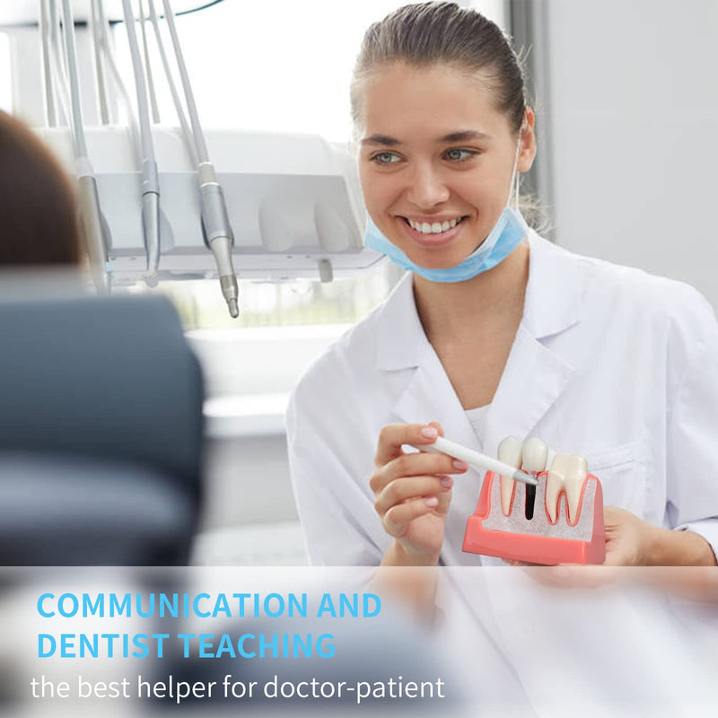 [Australia - AusPower] - ANNWAN Dental Implant Model 4 Times Removable Analysis Crown Bridge Demonstration Teeth Model for Class Education and Studying Teeth Model 