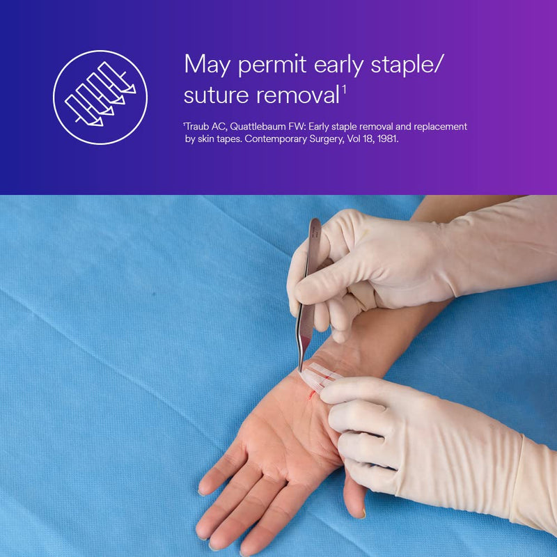 [Australia - AusPower] - 3M™ Steri-Strip™ Reinforced Adhesive Skin Closures, R1542, 1/4 in x 1-1/2 in, 50 Bag/Carton, 4 Carton/Case 