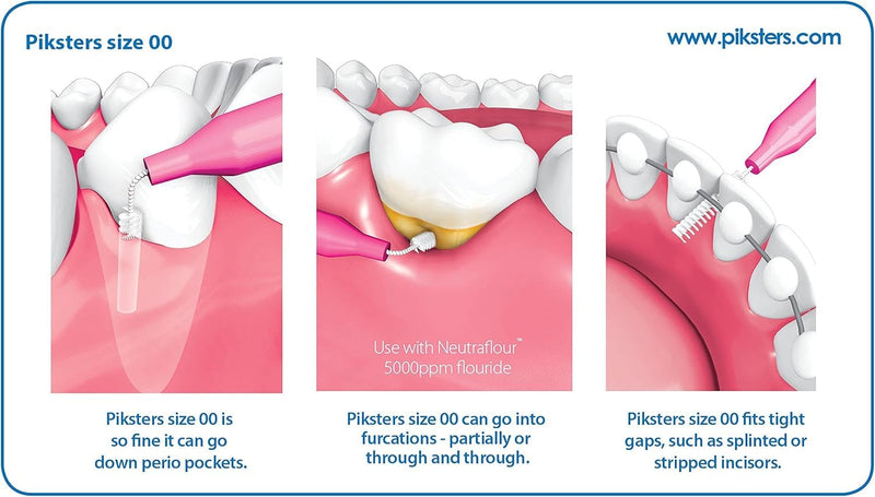 Piksters Interdental Brushes, Size 00, 100 Count (10 x 10 Packs), Interdental Tooth Brush for Extremely Tight Gaps, Gum Soft Bristles for Plaque Removal, Safe for Braces (100 pk) Size 00 (Pink) 100 Count (Pack of 1)