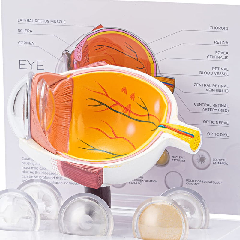 Cornea Eyeball Model Human Eye Model Human Eye Demonstration Teaching Prop Cataract Anatomy Medical Teaching Model