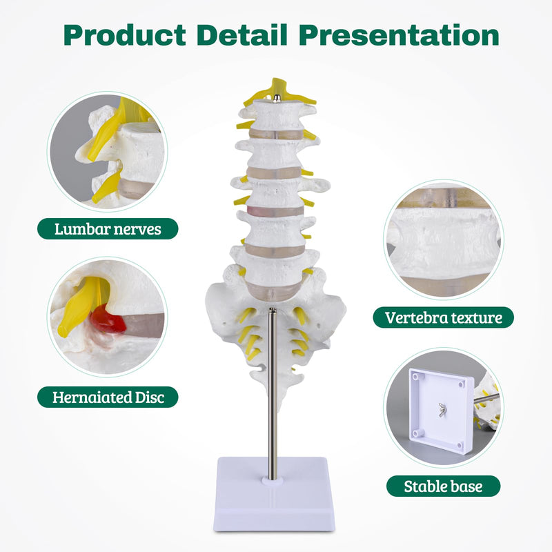 Ultrassist Human Lumbar Spine Model, Lumbar Vertebrae Anatomy Model with Herniation Discs, Lumbar Nerves and Spinal Cord for Medical Student Study Teaching