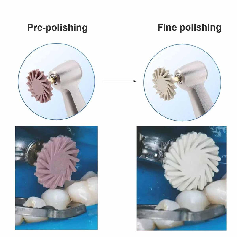 [Australia - AusPower] - Dental Composite Resin Polishing P2 Disc Polisher Wheels Diamond 2-Step Polishing System 14mm Wheel Kit Spiral P2 1.0 