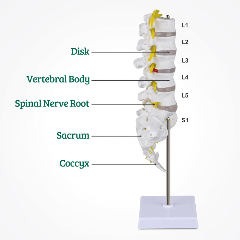 Ultrassist Human Lumbar Spine Model, Lumbar Vertebrae Anatomy Model with Herniation Discs, Lumbar Nerves and Spinal Cord for Medical Student Study Teaching