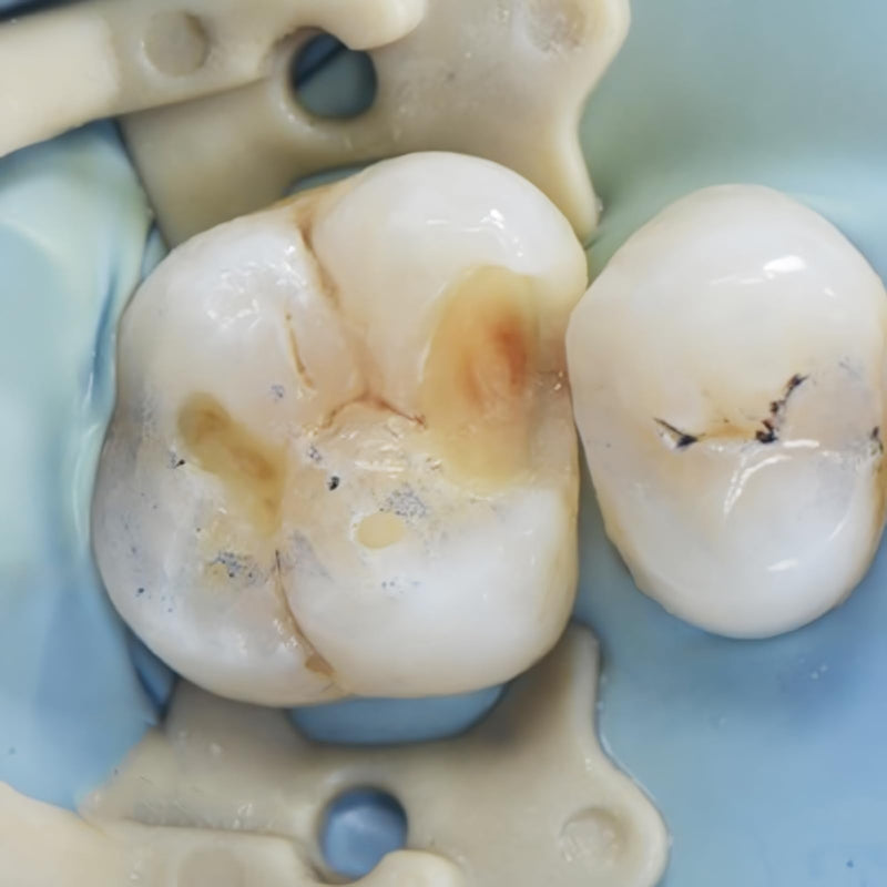 [Australia - AusPower] - Dental Rubber Dam Clamps Resin Rubber Barrier Clip Dental Endodental Rubber Dam Holder Autoclavable Dental Dentist Tools 