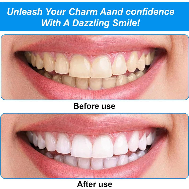 Tooth Sandpaper, 2 Rolls of Tooth Sandpaper, Sandpaper and Polishing Strips for Interdental Spaces, with 3 Teeth Erasers, Sandpaper for Teeth, for Smoothing (20 μm, 30 μm)