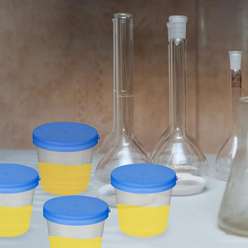 [Australia - AusPower] - EXCEART 50pcs Sterile Specimen Cups Specimen Collection Cups Urine Cups Pregnancy Test Cups Sample Containers with Lid for Laboratory 40ml Random Color 