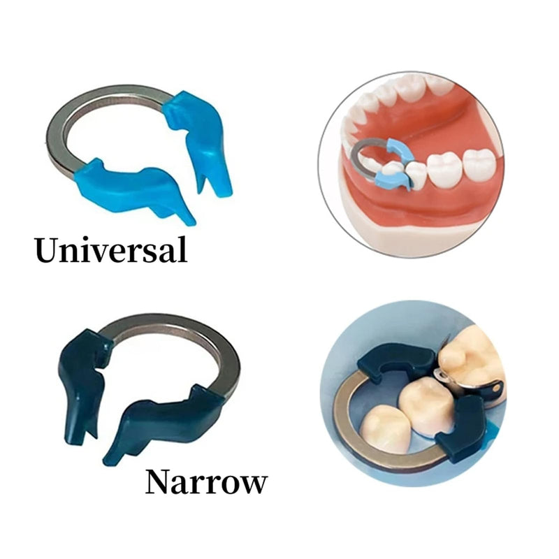 [Australia - AusPower] - Dental Sectional Matrix System, Dental Sectional Contoured Matrices Refill Matrix Bands, Sectional Contoured Metal Matrices, Nickel Titanium Clamp Ring Resin Holder Clip Ring-BLUE BLUE RING 