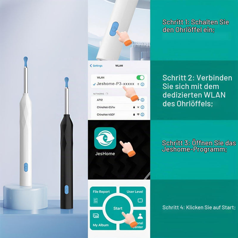 Ear Wax Remover Otoscope, WiFi 1080P HD Ear Cleaner, 360° Wide Angle Otoscope Camera for Otoscope IP67 Waterproof Otoscope Ear (White) White