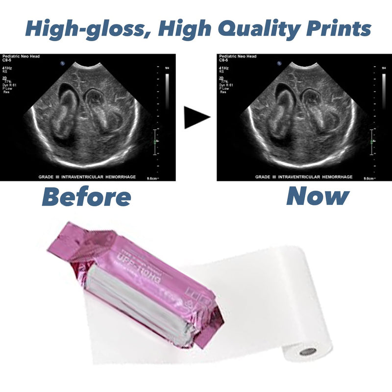 [Australia - AusPower] - UPP-110HG Ultrasound Paper Compatible for Sony, 2 Roll High Gloss Ultrasound Thermal Print Film/Media 110mm x 18m 