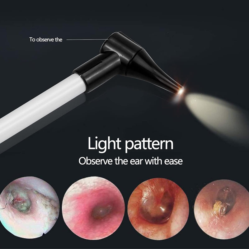 [Australia - AusPower] - Slimline Stainless Pocket Otoscope, Handheld Ear Scope Otoscope with Soft LED Light & 7 Specula Tips for Kids Adults Pets Animals 