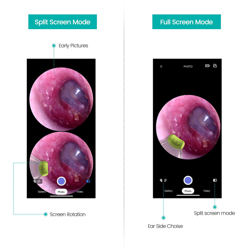 [Australia - AusPower] - ScopeAround Otoscope with Light, Ear Camera with Dual View, 720pHD/1080pFHD WiFi Ear Scope with 6 LED Lights, 3.9mm Lens Otoscope Camera for Kids and Adults, Ear Scope 