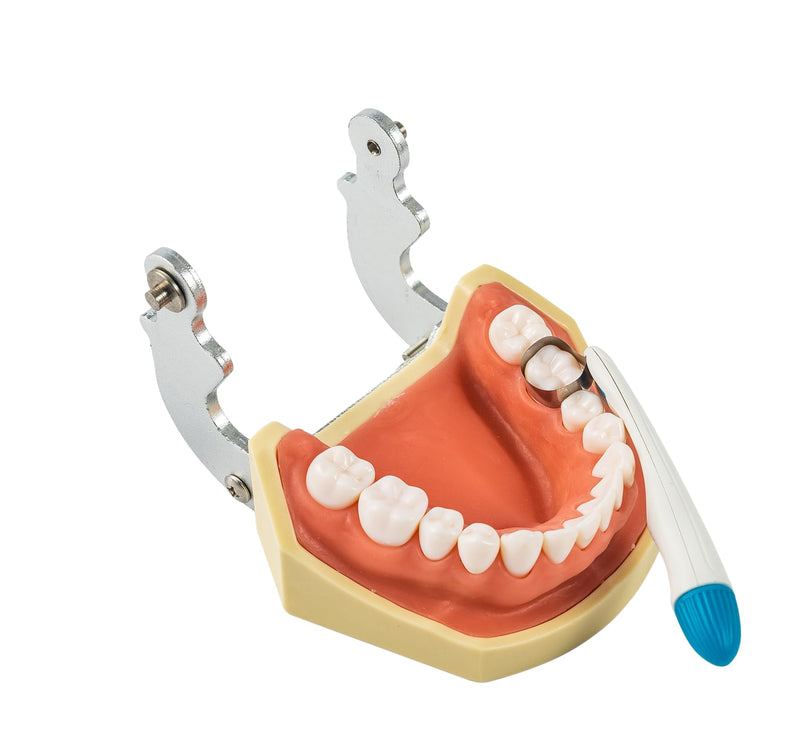 [Australia - AusPower] - 50pcs Dental Matrix Bands,Dental Sectional Matrix Refill Wedge for Teeth Restoration,Adjustable, 6mm Standard for Molars Blue 