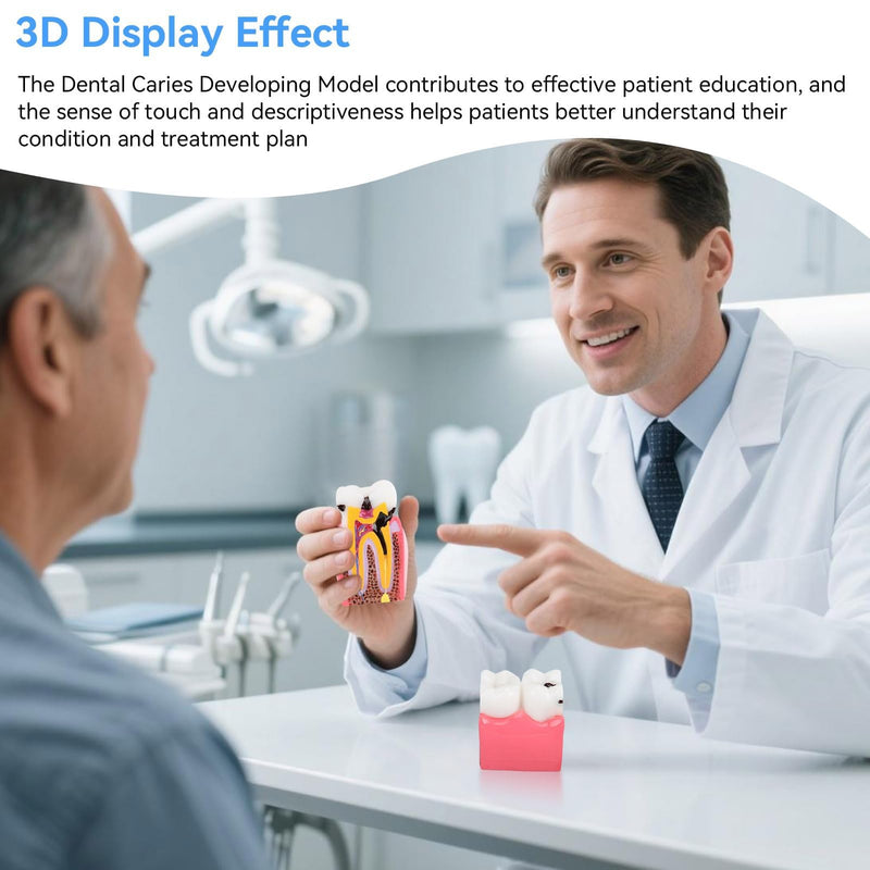 Dental Anatomy Model, Caries Comparison Study Models Dentist Dental Anatomy Training Dental Caries Development Model