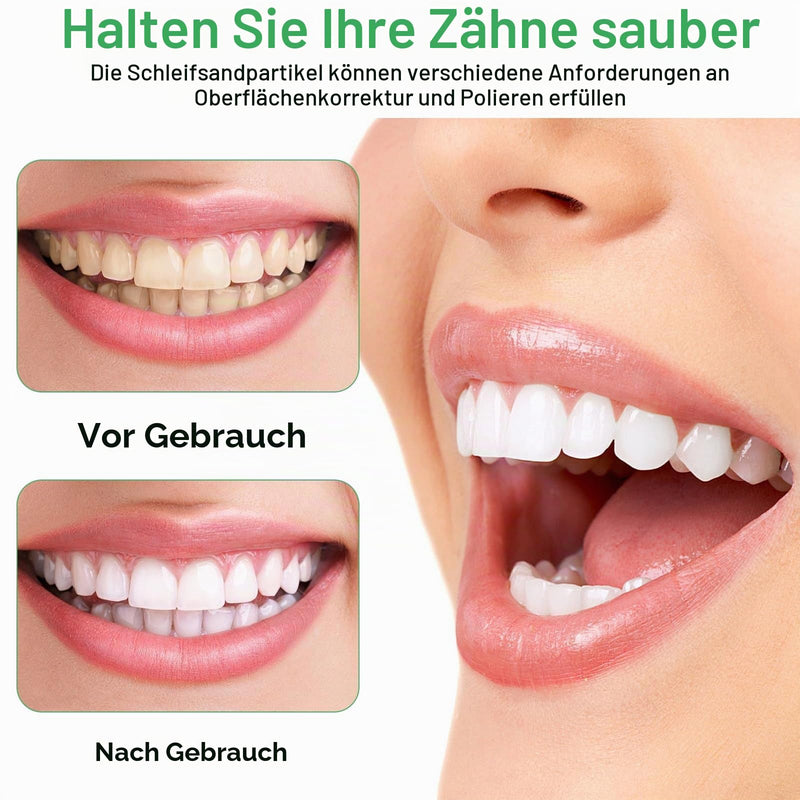 Tooth Sandpaper 5 Volumes Tooth Polishing Strips Tooth Belt Tooth Sandpaper Teeth Polishing Strips Teeth Polishing for Spaces 6 m Long