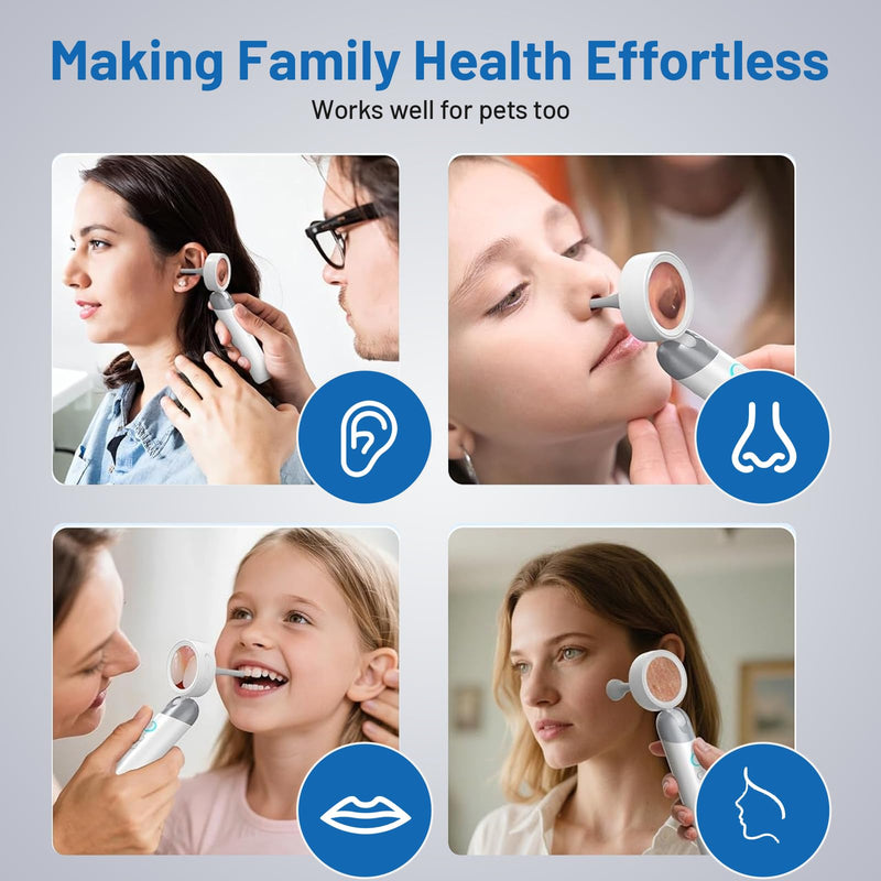[Australia - AusPower] - Professional HD Ear Camera Kit - 1080P Rotating Screen Ear Viewer with 4 LED Lights, 12 Silicone Tips & PC Connection | Portable Home Ear Inspection Tool for Family, Pets & Nursing Students 