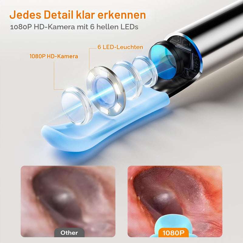 Ear Wax Remover Otoscope with Screen, Ear Cleaner with Otoscope for Home - No Phone, No App, No WiFi, One Button Operation, Wireless Earwax Camera 1080P HD
