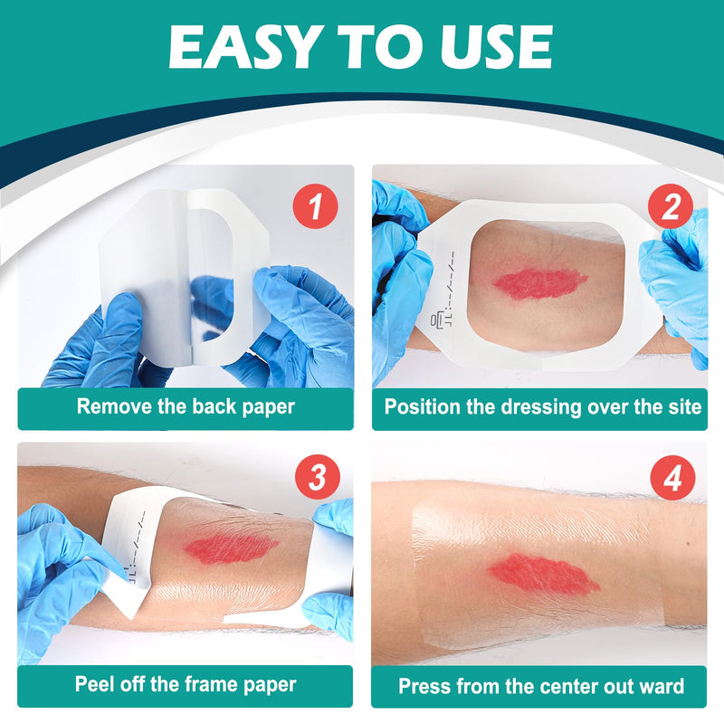 [Australia - AusPower] - Transparent Film Dressing 4" x 4.75" Box of 30 - Waterproof Bandages for Swimming, Showering, Wounds, Post Surgical Shower or IV Shield, Tattoo Aftercare Bandage, Scar Therapy, Adhesive Patches 4" x 4.75"(30 PCS) 