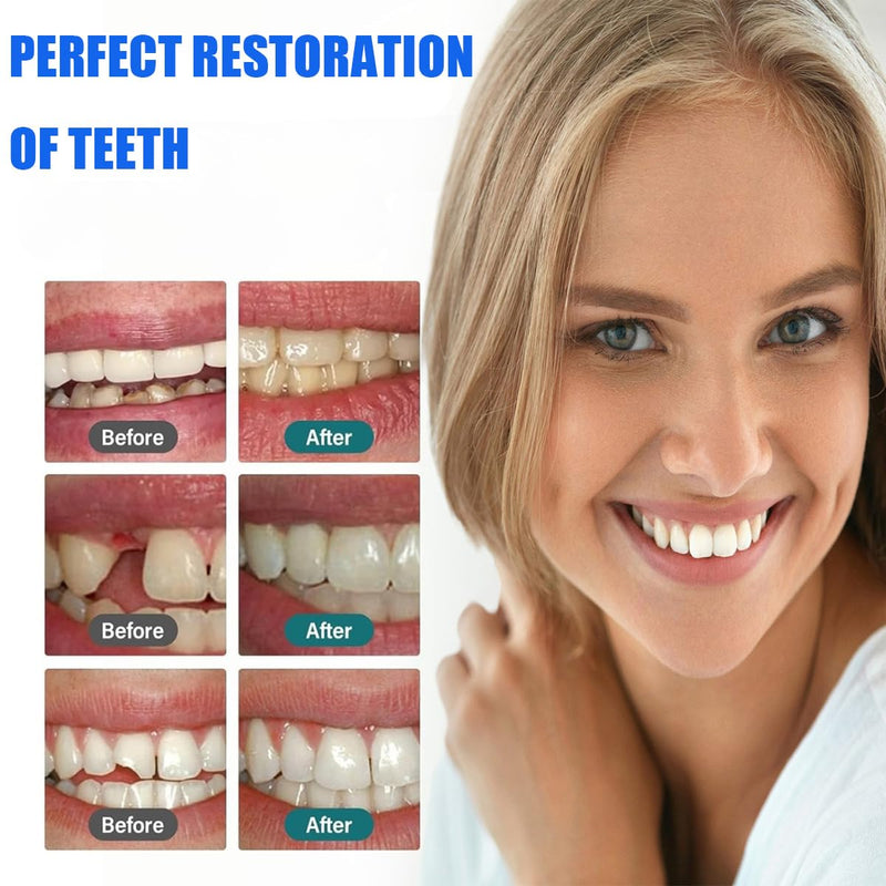 [Australia - AusPower] - Tooth Repair Kit, Temporary Teeth Replacement Kit, Zinc Oxide Eugenol Cement Dental for Broken Chipped Teeth, Missing Teeth, Crown Fillings & Bridges, Improving Smile 1pcs 