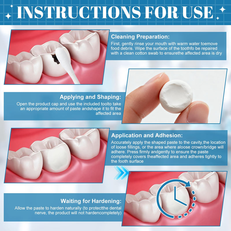 Tooth filling, temporary tooth filling, tooth cement self-hardening, durable, tooth repair kit, temporary tooth filling material for fillings for caries/attachment of coronations - 15 g