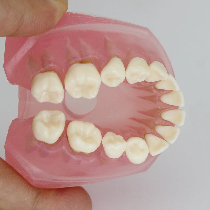 [Australia - AusPower] - Dental Implant Teeth Model Study Teach Standard Model with Removable Teeth 