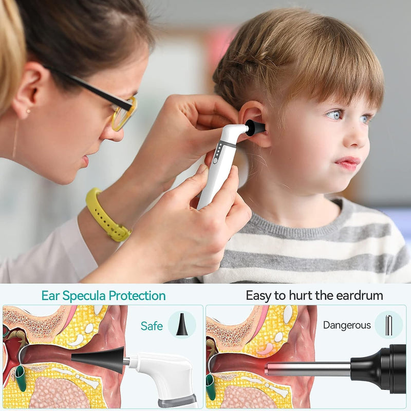 [Australia - AusPower] - Ear Specula Set for ScopeAround Digital Otoscope, Set of 50 Pieces, Replacement Otoscope Tips, Ear Speculum, Compatible with ScopeAround SA39W/SA39i/M28/MS450 Otoscope 