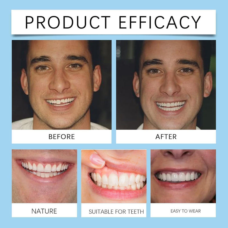 [Australia - AusPower] - Denture Silicone Reline Kit, Greatfit Denture Silicone Reline Kit, Soft Denture Reline Kit, Soft Denture Reline Kit for Men and Women (2pcs) 