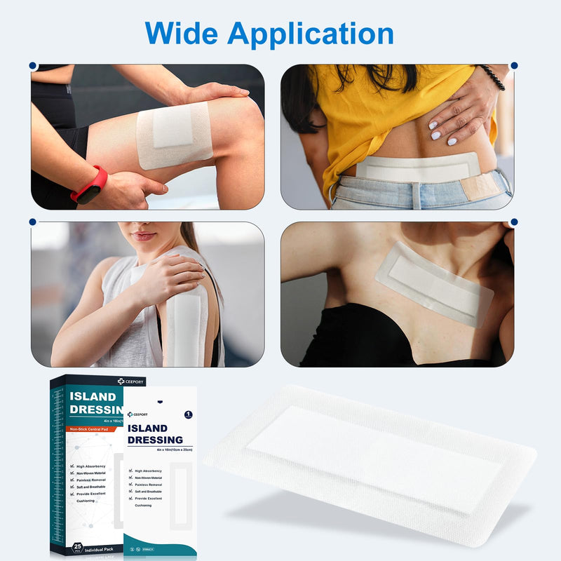[Australia - AusPower] - Island Dressing Bordered Gauze 4"x10", 25 Individually Packed Non-Stick Pad in Center with Adhesive Border,Soft & Highly Absorbent Medical Grade Dressing Gauze Pad for Wound Care and First Aid 