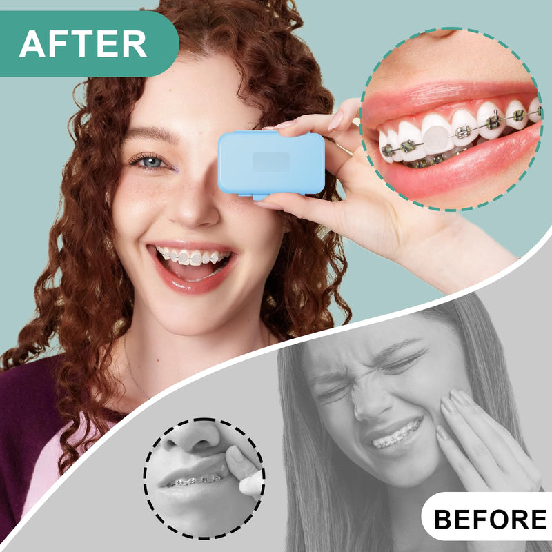 10 Boxes of Dental Wax for Braces, Braces Wax with Fruit Odour, Dental Care Silicone Orthodontic, Carrier Gum Protection, Tooth (10 Fragrance) 10Color1