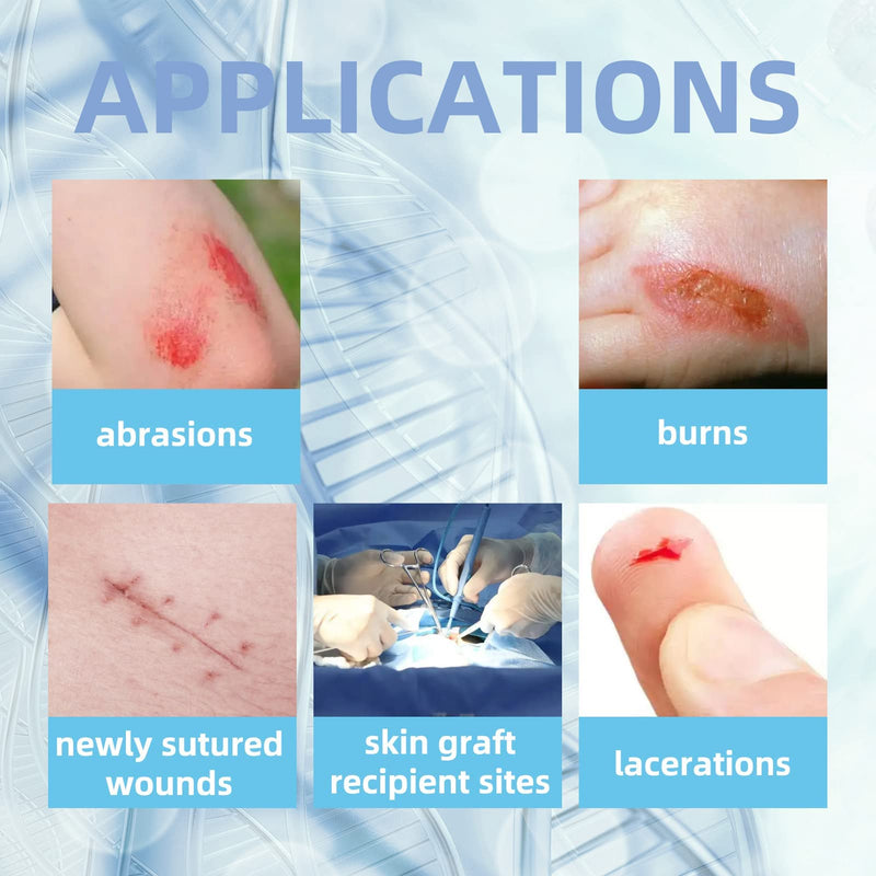 [Australia - AusPower] - Dr.Med Xeroform Petrolatum Dressing Patch, 5"x9"-30 Pcs/Box, Non-Adherent Gauze Dressings, for Minor or Partial Thickness Burns, Lacerations, Skin Graft Recipient Sites, Newly Sutured Wounds 5"x9" (30 Pcs/Box) 