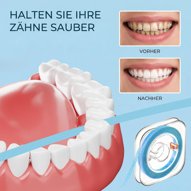 4 Bands Tooth Sandpaper Interdental Spaces, 20/30/50μm Tooth Polishing Strips, Safe and Durable for Cleaning Between Teeth