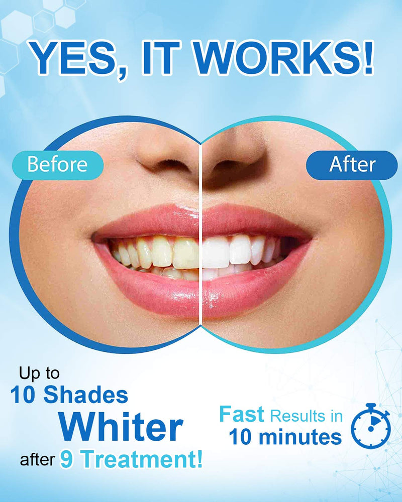 [Australia - AusPower] - MySmile Non-Sensitive Teeth Whitening Pen Mint Gel Enamel Safety 8ML 30+ Treatments Fast Remove 20 Years of Stains Care Oral Bright Smile Alternative Teeth Whitening Strips ﻿ Dark Blue 