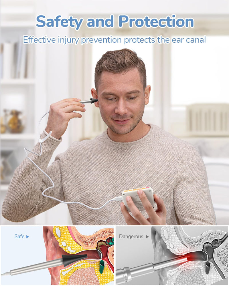 [Australia - AusPower] - Ear Specula Set for ScopeAround Digital Otoscope, Set of 50 Pieces, Replacement Otoscope Tips, Ear Speculum, Compatible with ScopeAround SA39W/SA39i/M28/MS450 Otoscope 