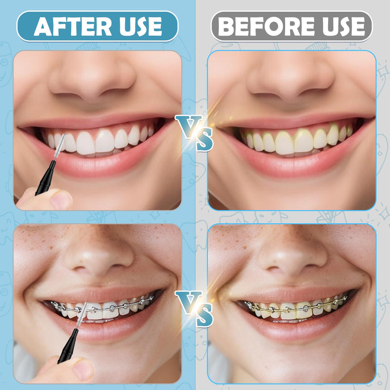 [Australia - AusPower] - 120 Pieces Braces Flossers for Cleaner Interdental Brushes Between Teeth, Toothpick Dental Tooth Flossing with Soft Bristles 360° Bendable Oral Dental Hygiene Flosser Cleaning Tool Black 