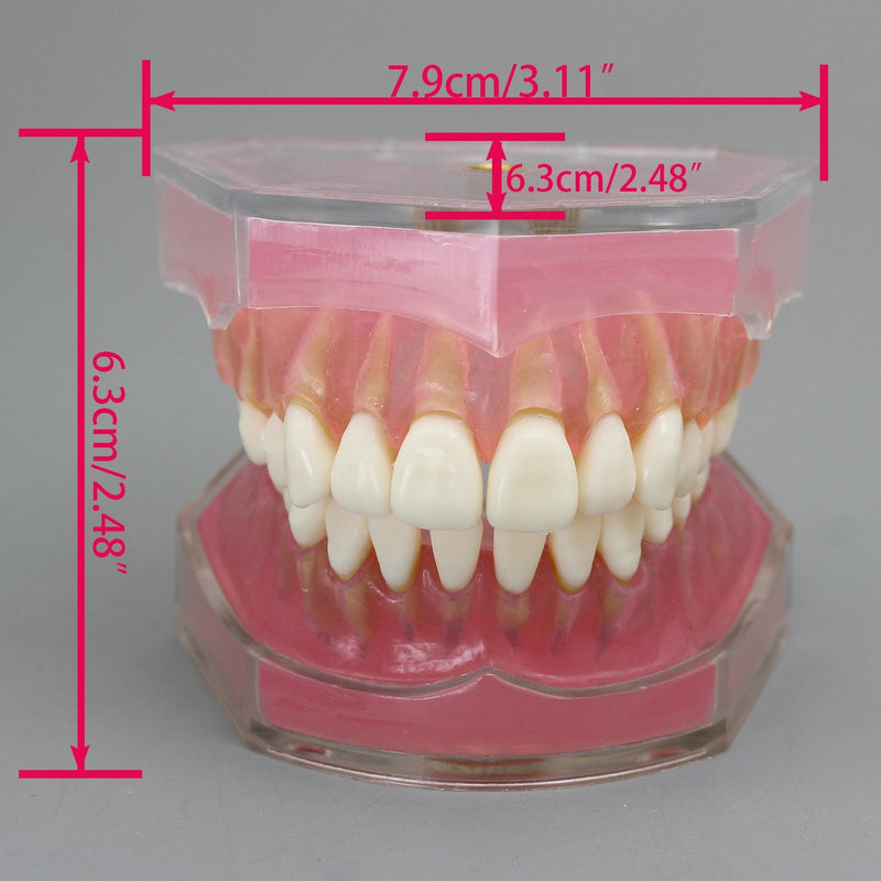[Australia - AusPower] - Dental Implant Teeth Model Study Teach Standard Model with Removable Teeth 