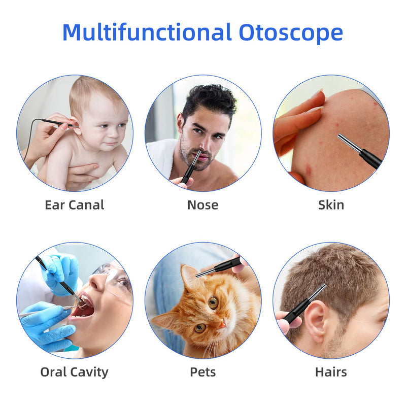 [Australia - AusPower] - Jiusion 3.9mm Ultra-Thin Portable USB Digital Otoscope Camera with Carrying Case, HD 720P 6 LED Visual Ear Scope with 3 Hats 2 Silicone Caps 8 Earwax Spoons for Android Windows Mac NOT for iPhone iPad 