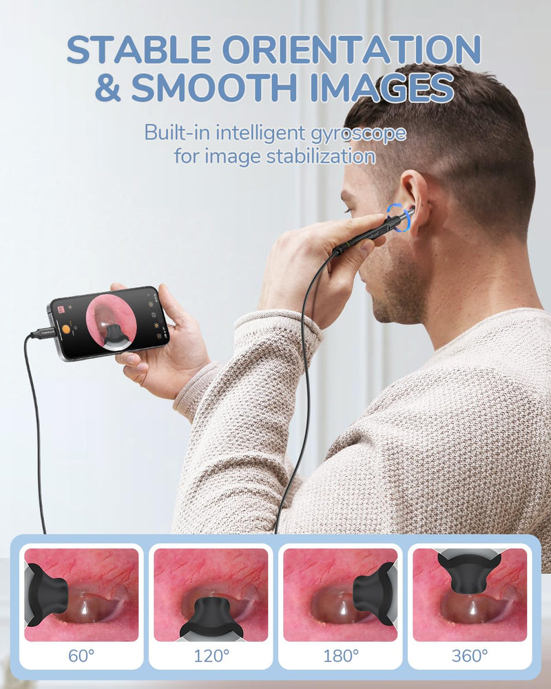[Australia - AusPower] - ScopeAround Otoscope with Light, Ear Camera with Dual View, 720pHD/1080pFHD WiFi Ear Scope with 6 LED Lights, 3.9mm Lens Otoscope Camera for Kids and Adults, Ear Scope 