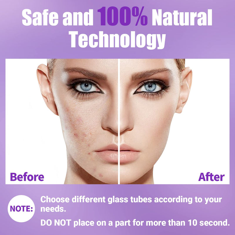 [Australia - AusPower] - High Frequency Facial Wand-UUPAS Portable Handheld High Frequency Facial Machine Skin Facial Wand with 4 Violet Tubes 