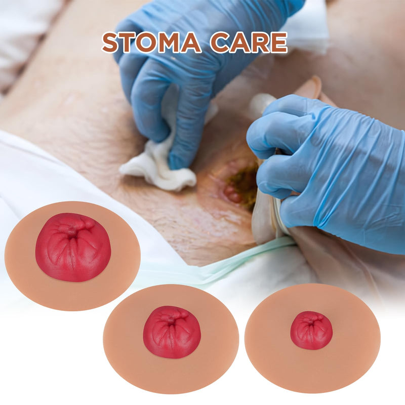 [Australia - AusPower] - Sticky Colostomy Simulators, Stoma Training Model Set, Multi-Skin Tone Ostomy Care Practice Models for Medical Training and Patient Education- Tan 