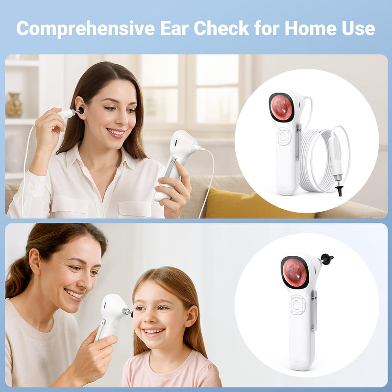 [Australia - AusPower] - ScopeAround Otoscope with Light, 720P HD Ear Cleaning Camera & 6 LED Lights Ear Scope, 1.45" IPS Display Digital Otoscope, Ear Scope with Extention Cable, Smart Ear Camera, Ready to Use White 
