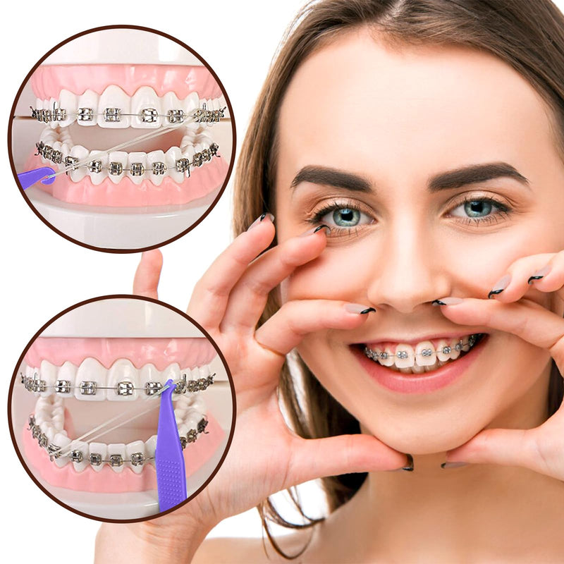 VEGCOO Pack of 600 Orthodontic Rubber Bands, 1/8 Inch, Braces Accessories with 6 Pieces Placer, Dental Orthodontic Rubber Bands for Dental Braids Braces (Squirrels) Squirrel