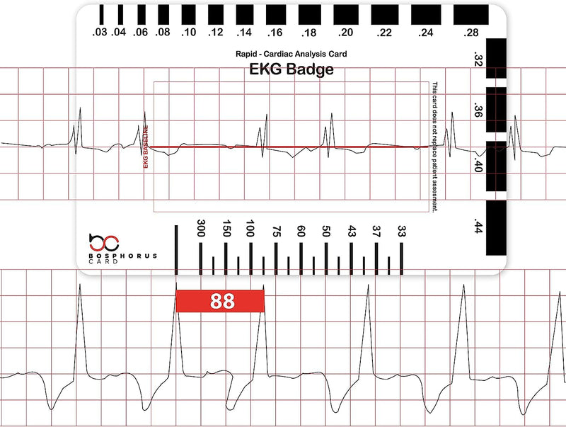 [Australia - AusPower] - EKG PVC Badge Card – Accurately Interpret ECG/EKG Rhythm Strips and 12 Lead EKG Without EKG Calipers – for Nurse NHS or Anyone in Healthcare! 