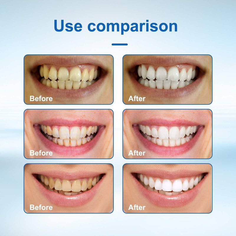 60 Pieces Teeth Sandpaper Tooth Polishing Strips for Spaces, Removal of Teeth Discolouration, Polishing Strips for Interdental Spaces, Cleaning and Polishing Tool for Interdental Spaces