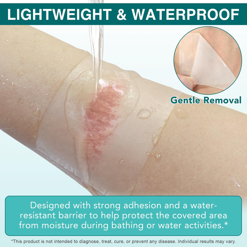 Hydrocolloid Roll 2 in x 12 ft, Cut to Size Skin Protection Tape, Anti Friction Barrier for Feet Heel Toes, Waterproof Flexible Adhesive for Shoe Rubbing, Walking Running Hiking Foot Care