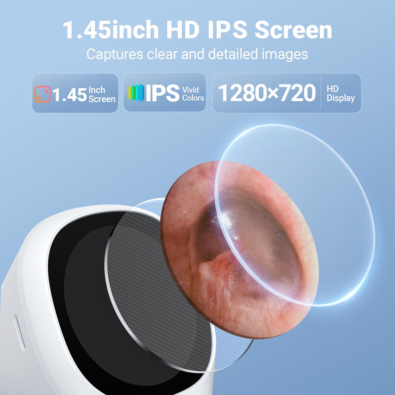 [Australia - AusPower] - ScopeAround Otoscope with Light, 720P HD Ear Cleaning Camera & 6 LED Lights Ear Scope, 1.45" IPS Display Digital Otoscope, Ear Scope with Extention Cable, Smart Ear Camera, Ready to Use White 