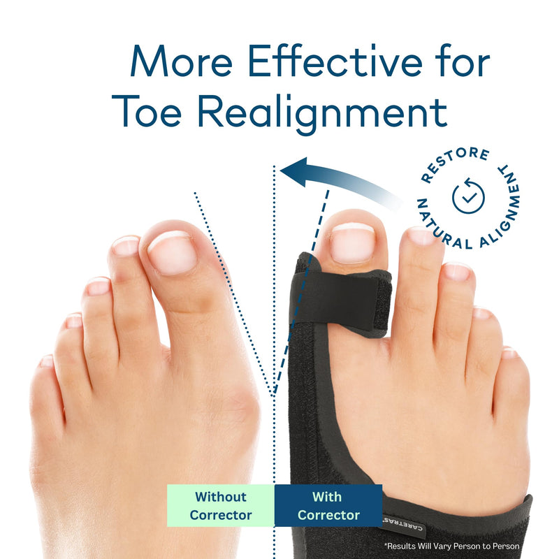 [Australia - AusPower] - Caretras Bunion Corrector, Orthopedic Bunion Splint, Big Toe Separator Pain Relief, Non-Surgical Hallux Valgus Correction, Hammer Toe Straightener, Day Night Support (Simple Elegant (2 Count)) 