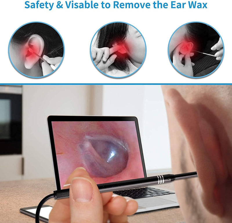 [Australia - AusPower] - 3in1 USB Otoscope-Ear Scope Camera, Mini New Upgraded 5.5mm Diameter Visual Ear Camera HD Ear Endoscope with Earwax Cleaning Tool and 6 Adjustable LED Lights for OTG Android and Windows & Mac. 