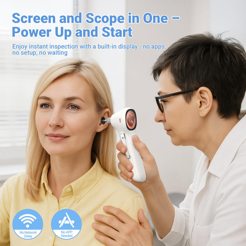 [Australia - AusPower] - ScopeAround Otoscope with Light, 720P HD Ear Cleaning Camera & 6 LED Lights Ear Scope, 1.45" IPS Display Digital Otoscope, Ear Scope with Extention Cable, Smart Ear Camera, Ready to Use White 