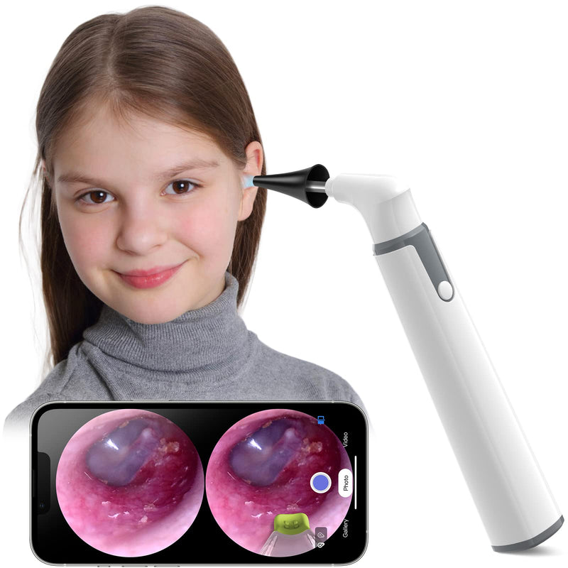 [Australia - AusPower] - ScopeAround Otoscope with Light, Ear Camera with Dual View, 720pHD/1080pFHD WiFi Ear Scope with 6 LED Lights, 3.9mm Lens Otoscope Camera for Kids and Adults, Ear Scope 