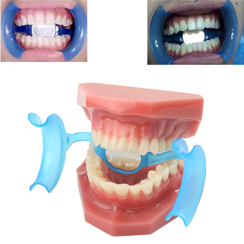 [Australia - AusPower] - Dental Cheek Retractor Mouth Opener M Shape Autoclavable with Mirror for Teeth Whitening Mouthpiece Dentist Tools(10Pcs Blue) 